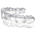 Aligner Treatment - Image 3