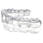 Clear Retainers