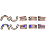 ‌Undertake orthodontic scheme design